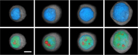 Imágenes tridimensionales de una célula mientras evoluciona de célula normal a cáncer invasor. (Imagen cortesía del doctor Deirdre Meldrum, Universidad Estatal de Arizona).