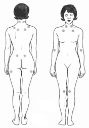 photo of a woman showing the location of the nine paired tender points that comprise the 1990 American College of Rheumatology criteria for fibromyalgia