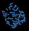 a microscopic image of chromosomes with visable telomeres.