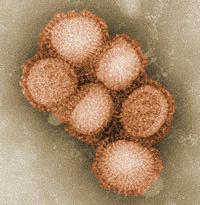 Negative stain EM image of the swine influenza