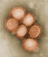 H1N1 Virus