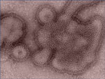 H3N2v Infection