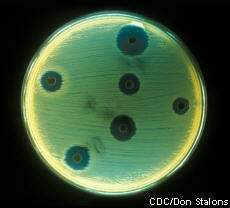 Fotografía de Estafilococo aureus en medios de agar