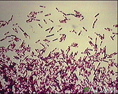 Fotografía de la bacteria Clostridium difficile