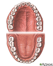Ilustración de dientes normales