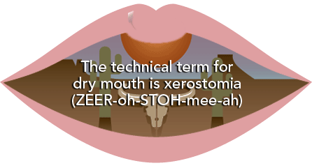 The technical term for dry mouth is xerostomia (ZEER-oh-STOH-mee-ah