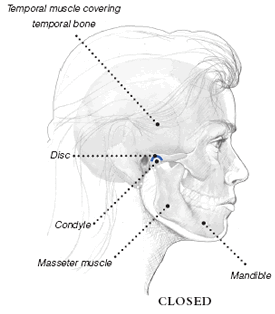 Profile of closed mouth showing temporal muscle covering temporal bone, disc, condyle, masseter muscle and mandible
