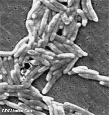 Electron micrograph of Campylobacter fetus bacteria
