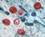 microscopic view of a pathogen