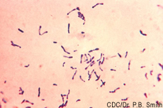 Photograph of the bacterium that causes diphtheria