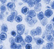 xenotropic murine leukemia virus (XMRV) virus particles