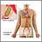 Stent de arteria coronaria