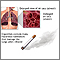 Hábito de fumar y EPOC (enfermedad pulmonar obstructiva crónica)