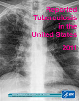Chart: Reported TB Cases, United States, 1993 and 2010. In 1993, 25,107 cases. In 2010, 11, 182 cases.
