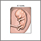 8.5 week fetus