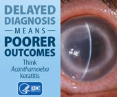 A square ad showing an infected eyeball with Acanthamoeba. The caption reads, "Delayed diagnosis means poorer outcomes - think Acanthamoeba keratitis."
