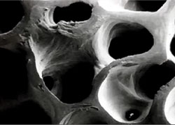 A healthy bone image