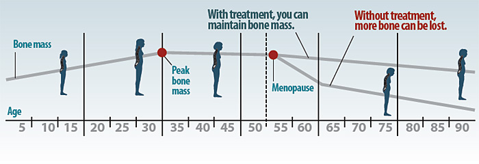 A timeline showing bone mass loss over a human lifespan