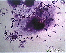 Photograph of the organism Pneumococci