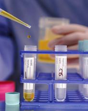 Photograph of test tubes in a tray