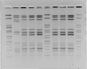 Photo of the results of pulsed-field gel electrophoresis (PFGE)