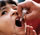 Photo of a child receiving the oral polio vaccine