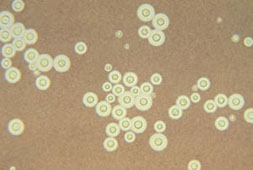 A photomicrograph of Cryptococcus neoformans using a light India ink staining preparation. Credit: CDC/ Dr. Leanor Haley.