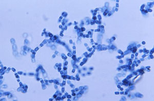 Image of Arthroconidia of Coccidioides immitis