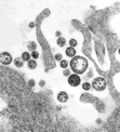 Electron micrograph image of Lassa virus.
