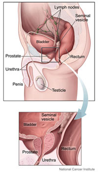Graphic: Medical illustration showing the location of the prostate.