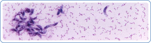 Toxoplasma gondii in mouse ascitic fluid. Smear.
