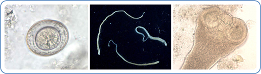 Left: H. nana egg in an unstained wet mount. Center: Three adult specimens of H. nana. Right: Scolex of H. nana in an unstained wet mount of stool under high magnification.