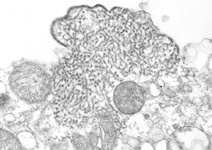 electron micrograph image of nipa virus
