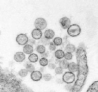 Electron micrograph of Sin Nombre virus isolate