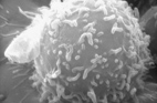 Black and white microscope image of human lymphocyte, which appears as a white ball with tendrils branching off from the surface.