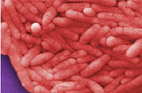 Salmonella typhi is a bacteria associated with some gallbladder cancers. Credit: CDC