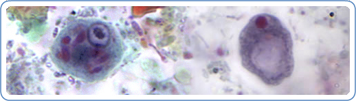 Left: E. polecki cyst stained with trichrome. Right: I. buetschlii cyst stained with trichrome.