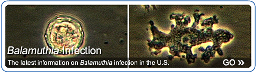 L: Cyst of B. mandrillaris. R: Trophozoite of B. mandrillaris in culture. Both images under high magnification. 