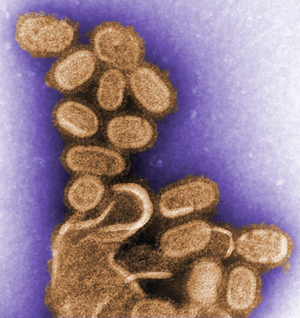1918 Flu Virus