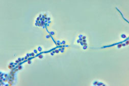 A photomicrograph showing the conidiophores and conidia of the fungus Sporothrix schenckii