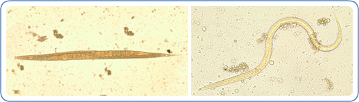 Left: Adult male of E. vermicularis from a formalin-ethyl acetate (FEA) concentrated stool smear. The worm measured 1.4 mm in length. Image courtesy of Centre for Tropical Medicine and Imported Infectious Diseases. Right: Image of the eggs of the human parasite Enterobius vermicularis, or 'human pinworm', captured on cellulose tape under significant magnification. 