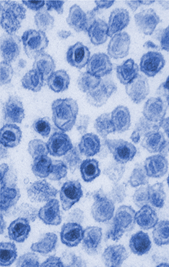 XMRV virus particles