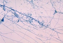 Photomicrograph of the dermatophyte Trichophyton mentagrophytes