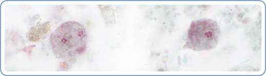 A binucleate and uninucleate form of trophozoites of D. fragilis, stained with trichrome.