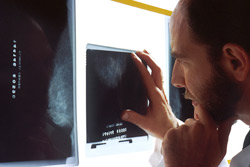 Physician analyzing a mammogram film