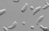 a photomicrograph of ﬁlamentous trophonts