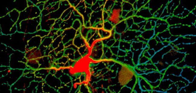 Photo: Advances in Vision Science from the National Eye Institute:

Retinal Foliage: A 3D view of a retinal ganglion cell: a nerve cell that relays light signals from the eye to the brain. (Courtesy of Wei Li, NEI Unit on Retinal Neurophysiology) 

http://www.nei.nih.gov/news/scienceadvances/index.asp