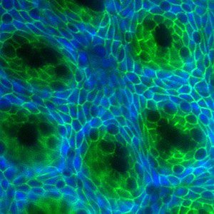 Photo: Crypts (dark green) are stem-cell-containing glands that help to regenerate the intestinal lining. Image by Hiroyuki Miyoshi, University of Washington in St. Louis.

Learn More at NIH Research Matters: http://www.nih.gov/researchmatters/october2012/10152012intestinal.htm