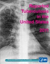 Photo: New CDC Tuberculosis Surveillance Report, 2011