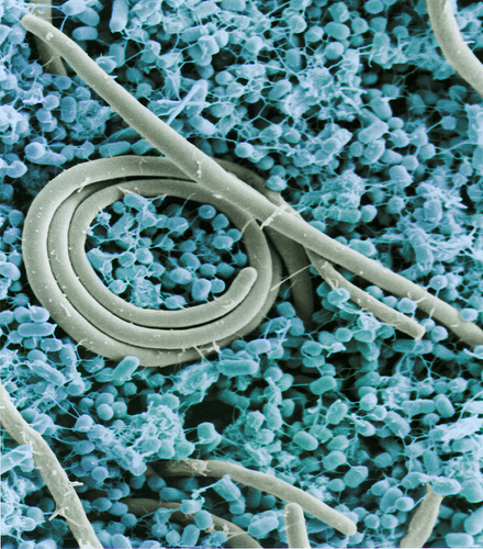 Colorized SEM (scanning electron micrograph) of the foodborne pathogen Salmonella enteritidis. Photo by Jean Guard, ARS.